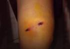 Joven baleada en un robo en barrio San Cayetano