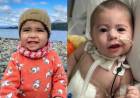 Trasplante inédito en Argentina: Felipe y Luca, la historia que conmovió al país
