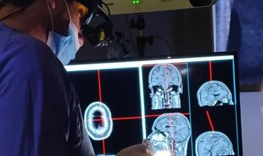 Se realizaron por primera vez en Córdoba tres neurocirugías inéditas