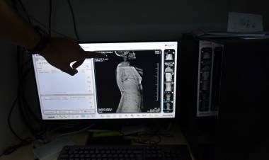 En la Asistencia Pública se realiza un nuevo estudio radiográfico  