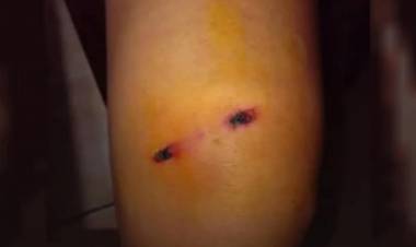 Joven baleada en un robo en barrio San Cayetano