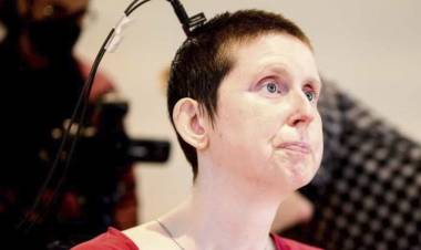 Una mujer vuelve a hablar tras 18 años gracias a un implante cerebral con IA