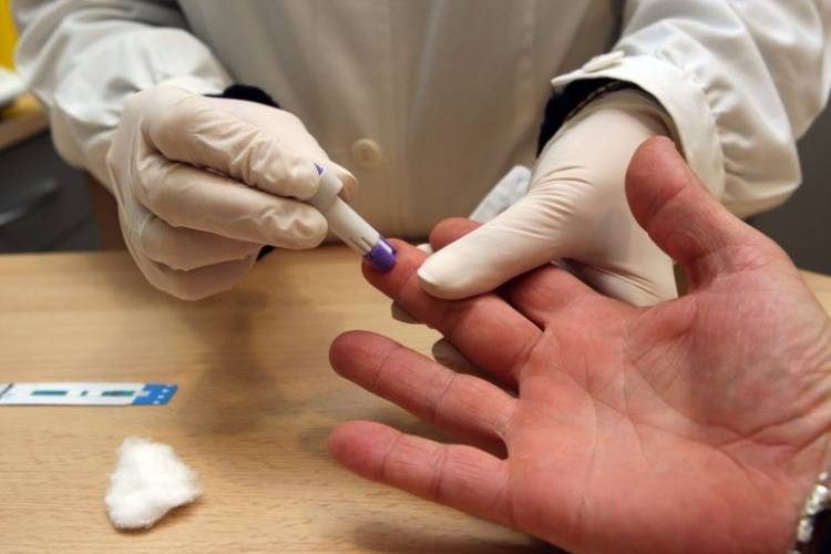 Campaña gratuita de testeo rápido de VIH y Sífilis en San Francisco